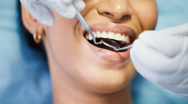 Best After-Hours Dental Trauma Care in Clifton Forge, VA