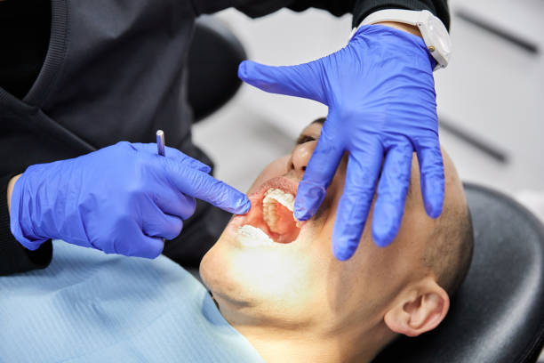 Best Emergency Dental Care for Broken or Chipped Teeth in Clifton Forge, VA