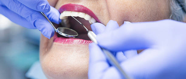 Best Emergency Treatment for Dental Infections or Abscesses in Clifton Forge, VA